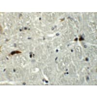 RABGEF1 Antibody
