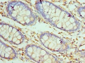 Polyclonal Rabbit anti-Human CARD8 / Cardinal / TUCAN Antibody (aa1-200, IHC)