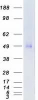 Human TGFBR1 / ALK5 Protein (Recombinant Myc-DDK (Flag))