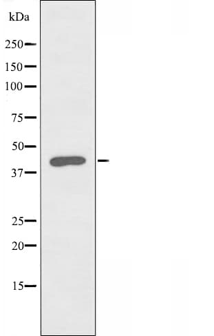 CSNK1E / CK1 Epsilon Antibody