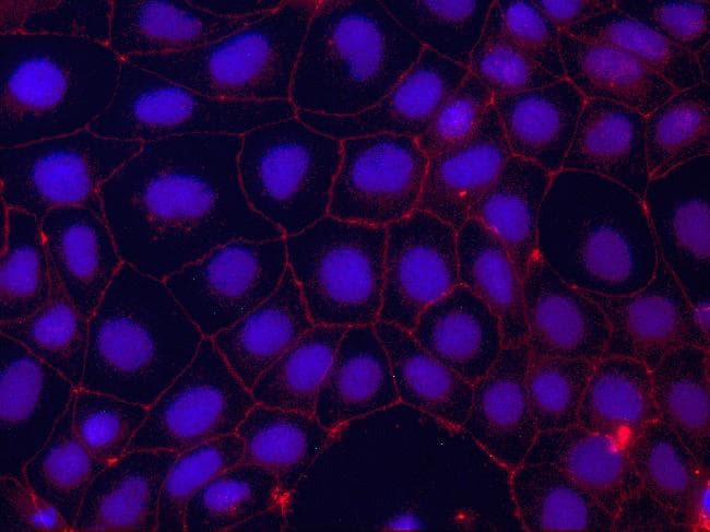 Monoclonal Mouse anti-Human CLDN4 / Claudin 4 Antibody (clone 3E2C1, AF594, C-Terminus, IF, WB)