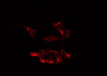 ABCB7 Antibody