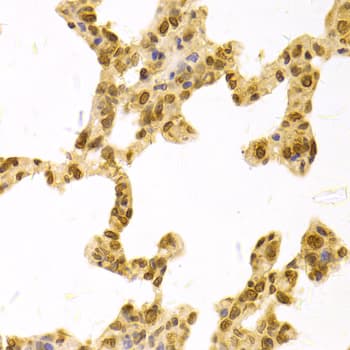 Polyclonal Rabbit anti-Human TMPO / TP / Thymopoietin Antibody (IHC, IF, WB)
