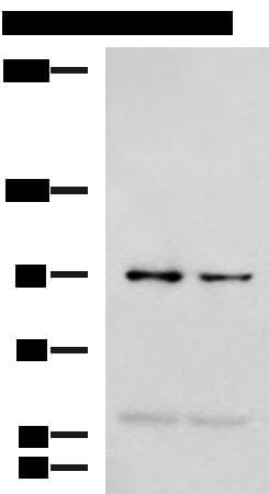NVL Antibody