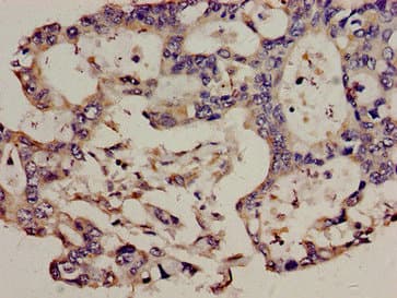 T-cell receptor beta-chain V region, clone WBDM28A Antibody