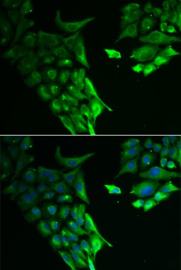 Polyclonal Rabbit anti-Human HABP2 Antibody (IHC, IF, WB)