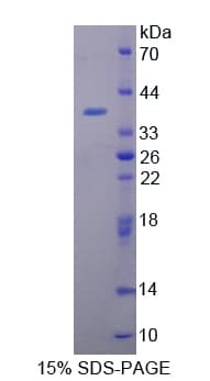 Mouse TOR1A / Torsin A Protein (Recombinant His-T7)
