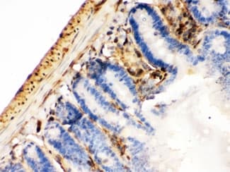 Polyclonal Rabbit anti-Human LGALS1 / Galectin 1 Antibody (IHC, WB)