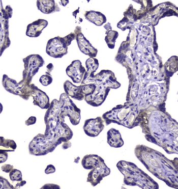RAB6A / RAB6 Antibody