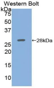 ADCY5 / Adenylate Cyclase 5 Antibody (aa167-385)