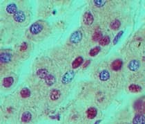 NPM1 / NPM / Nucleophosmin Antibody (aa21-38)