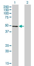 Monoclonal Mouse anti-Human NFE2 / p45 Antibody (clone 2C6, WB)