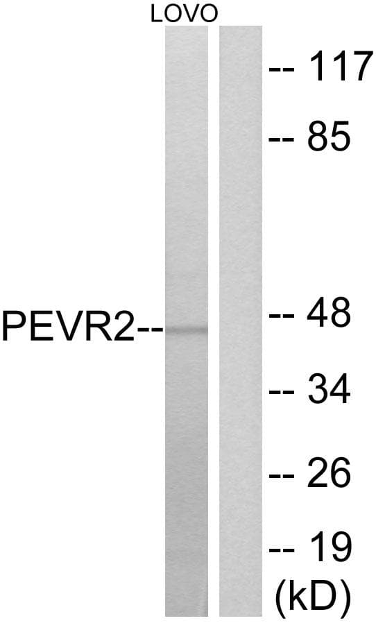 SLC52A1 / GPR172B / PAR2 Antibody