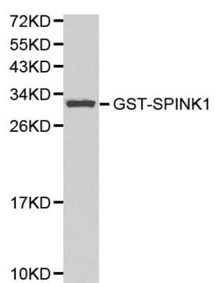 SPINK1 Antibody