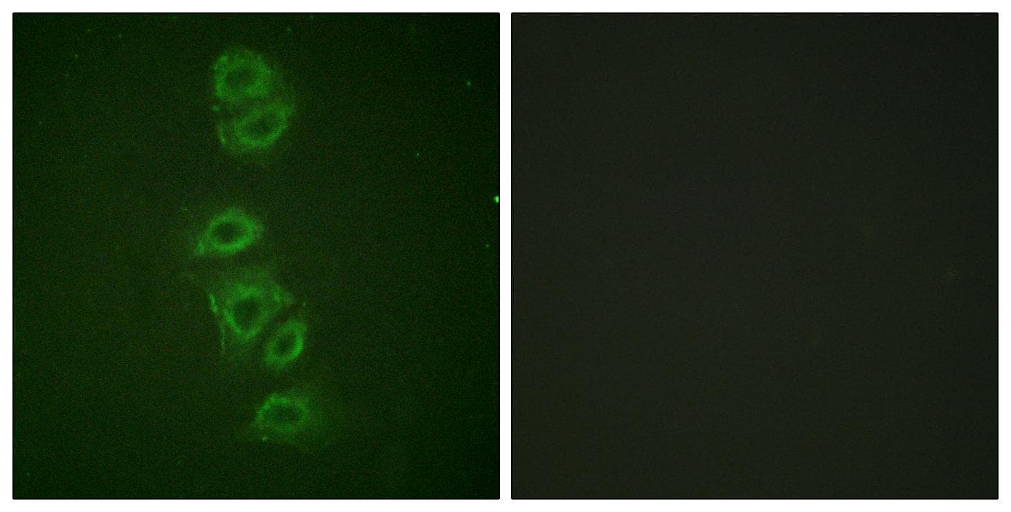 Polyclonal Rabbit anti-Human PP2Ac / PPP2CA Antibody (phospho-Tyr307, IHC, IF, WB)