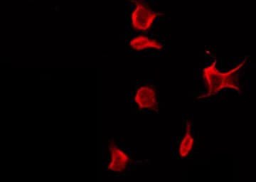 PDE10A Antibody
