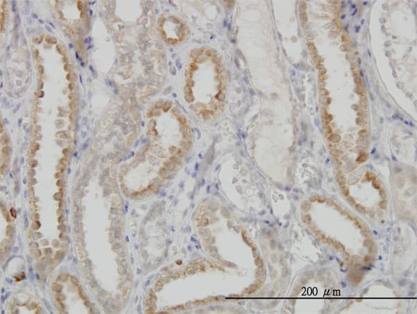 NDUFS3 Antibody (clone 1D6)