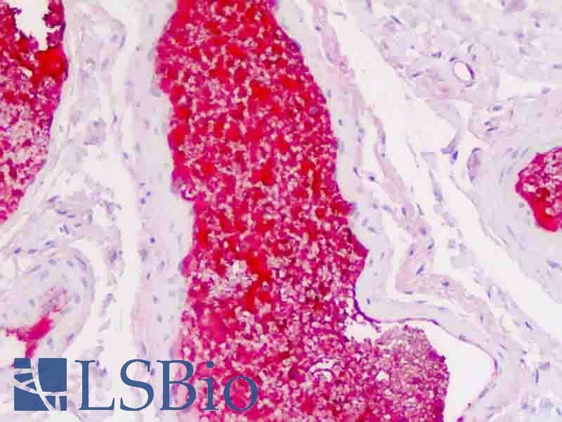 IHC-plus™ Monoclonal Mouse anti-Human SERPINA1 / Alpha 1 Antitrypsin Antibody (IHC)