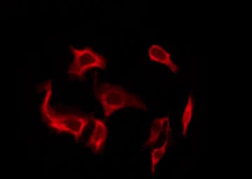 Polyclonal Rabbit anti-Human GIPR / GIP Receptor Antibody (IHC, IF, WB)