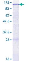 Human LRP10 Protein (Recombinant GST)