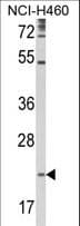 Polyclonal Rabbit anti-Human TSPAN31 Antibody (aa102-128, WB)