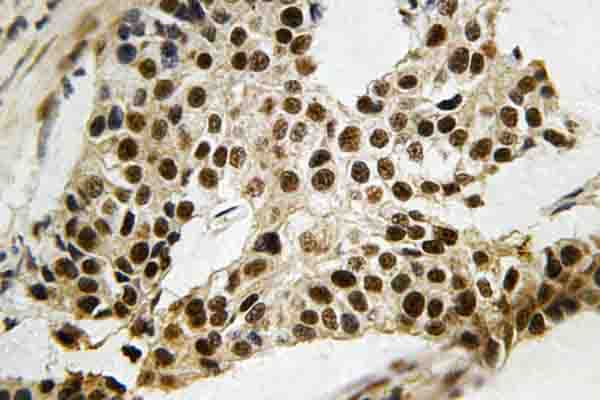 MAPKAPK2 / MAPKAP Kinase 2 Antibody (Asn266)