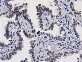 MEF2C Antibody (clone OTI4F7)