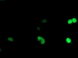 Monoclonal Mouse anti-Human LHX1 Antibody (clone OTI2D3, IHC, IF, WB)