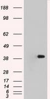 Monoclonal Mouse anti-Human MAPK1 / ERK2 Antibody (clone OTI1D3, WB)