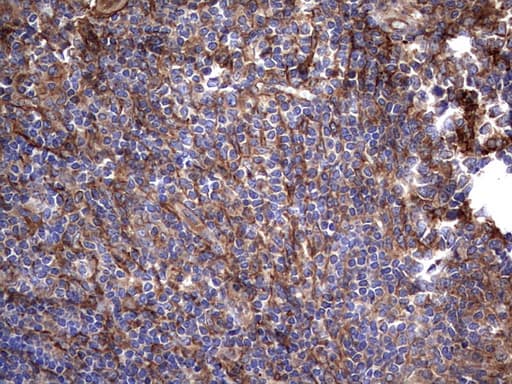 KRT7 / CK7 / Cytokeratin 7 Antibody (clone OTI2A2)
