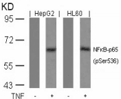 Polyclonal Rabbit anti-Human RELA / NFKB p65 Antibody (IHC, WB)