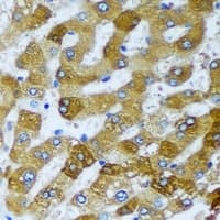 Polyclonal Rabbit anti-Human CHIA / Amcase Antibody (IHC, WB)
