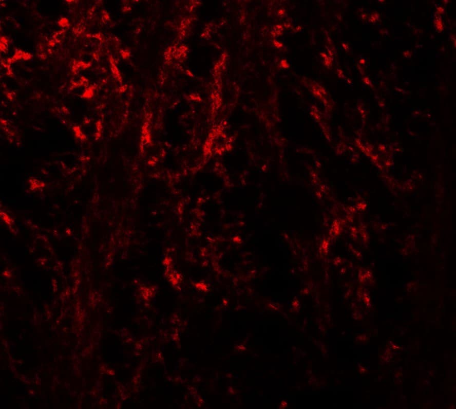 IHC-plus™ NINJ1 / Ninjurin Antibody