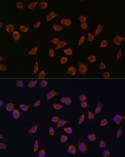 Polyclonal Rabbit anti-Human ACSS1 Antibody (IF)