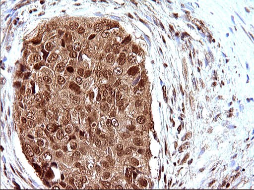 LZIC Antibody (aa1-190, clone OTI3A7)