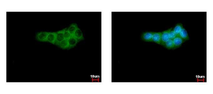 IHC-plus™ Polyclonal Rabbit anti-Human GPI Antibody (IHC, IF, WB)