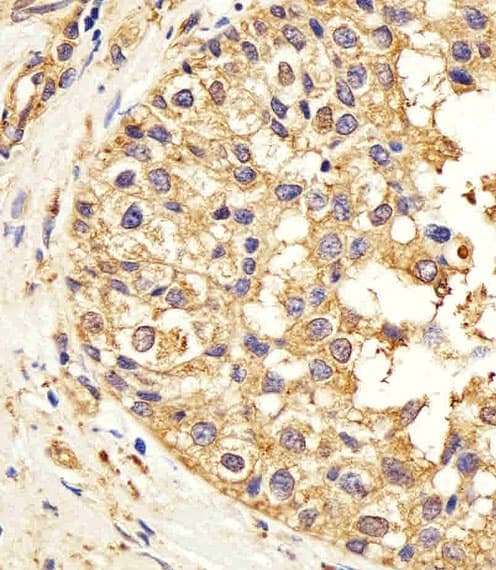CTSD / Cathepsin D Antibody