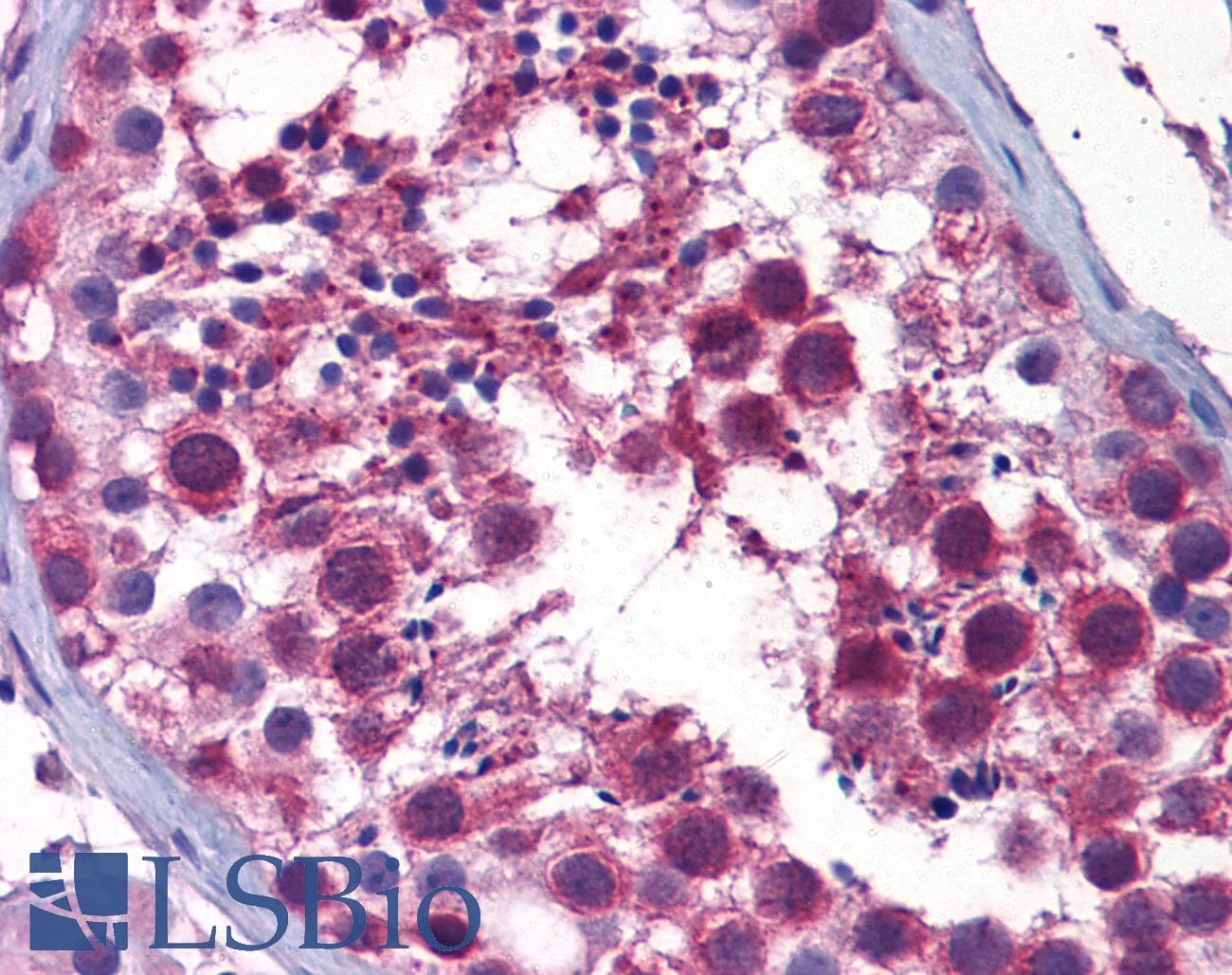 IHC-plus™ Monoclonal Mouse anti-Human STK38 Antibody (clone 6F1, IHC, WB)