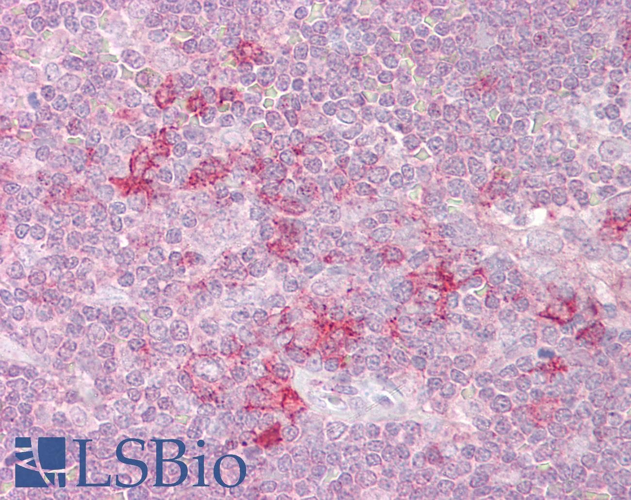 IHC-plus™ Polyclonal Goat anti-Human STK26 / MST4 Antibody (aa340-354, IHC, WB)