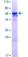 Human RPUSD1 Protein (Recombinant GST)