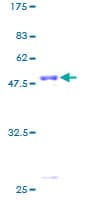 Human PLDN / Pallidin Protein (Recombinant GST)