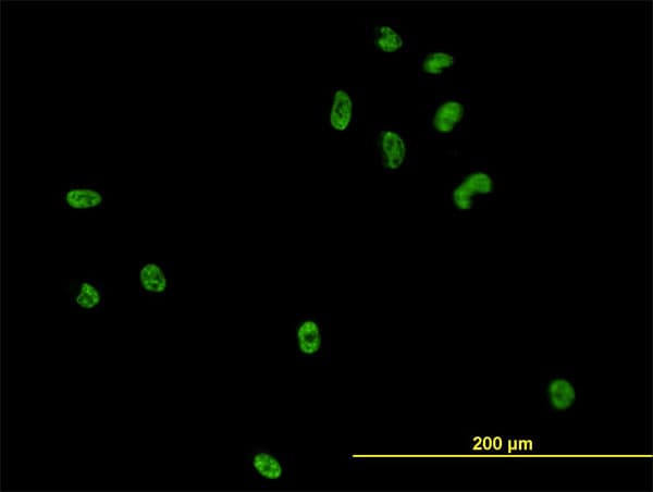 Monoclonal Mouse anti-Human CSE1L Antibody (clone 3D8, IF, WB)