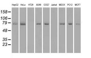 IHC-plus™ KIND2 / FERMT2 Antibody (clone 9E4)
