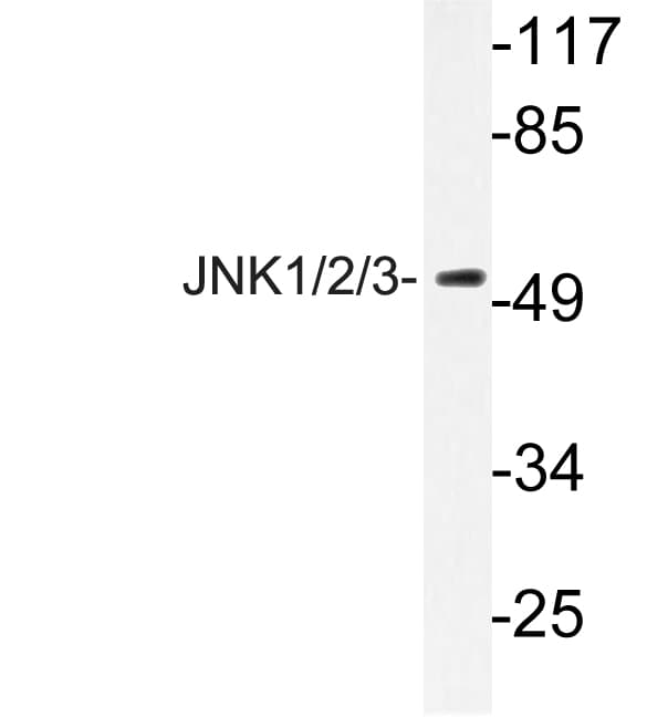 JNK1+2+3 Antibody (Tyr185)