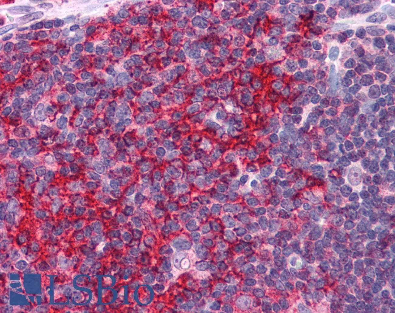 IHC-plus™ Polyclonal Rabbit anti-Human EFHD2 Antibody (IHC, IF, WB)