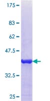 Human Properdin / CFP Protein (Recombinant GST, N-terminus)