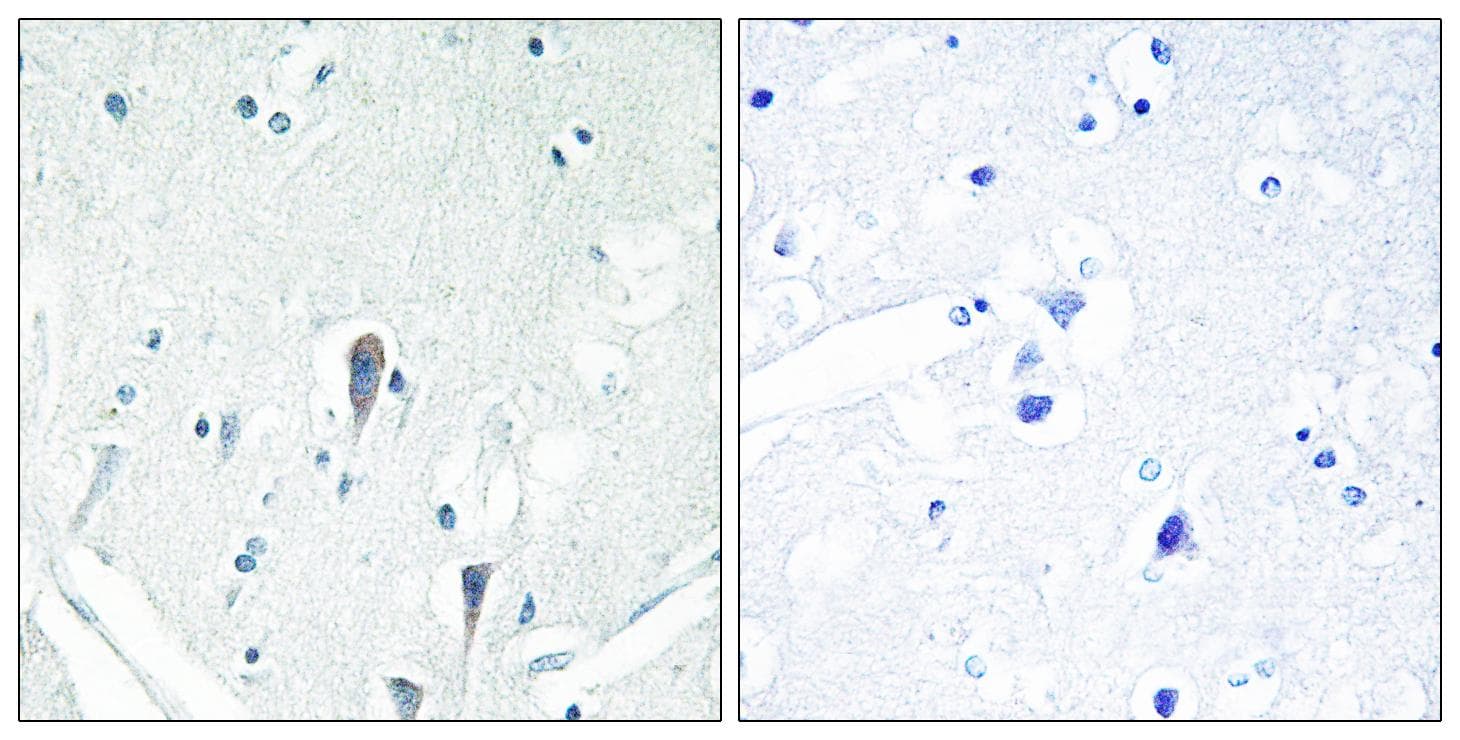 Polyclonal Rabbit anti-Human IRAK3 / IRAKM / IRAK-M Antibody (IHC, IF, WB)