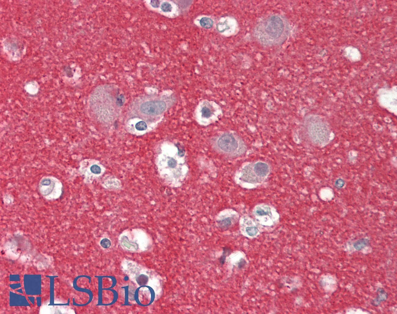 Polyclonal Rabbit anti-Human ZMYND15 Antibody (aa137-186, IHC, WB)