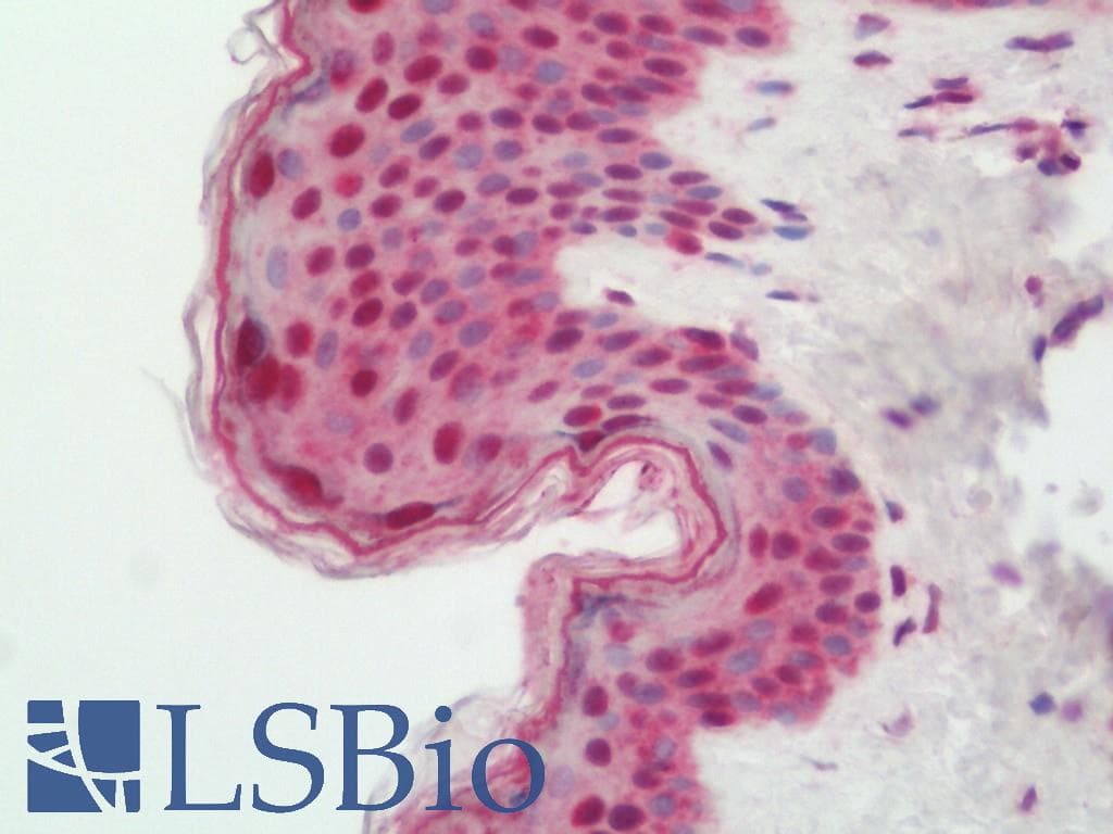 Polyclonal Rabbit anti-Human BATF3 Antibody (IHC, IF, WB)