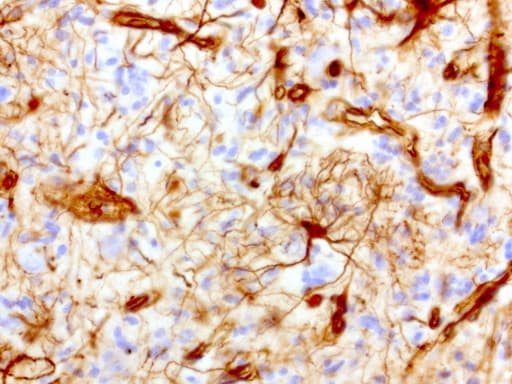 Monoclonal Mouse anti-Human Vimentin Antibody (clone UMAB160, IHC, IF, WB)